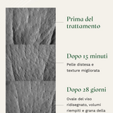 MIRABILIFT - 10+ Siero antirughe efficace in 15 minuti con Picnogenolo® e Acido Ialuronico
